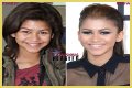 Unveiling The Secrets Of Zendaya's Nose Job: Discoveries And Insights